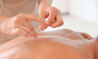 Acupuncture À quoi sert-elle ?